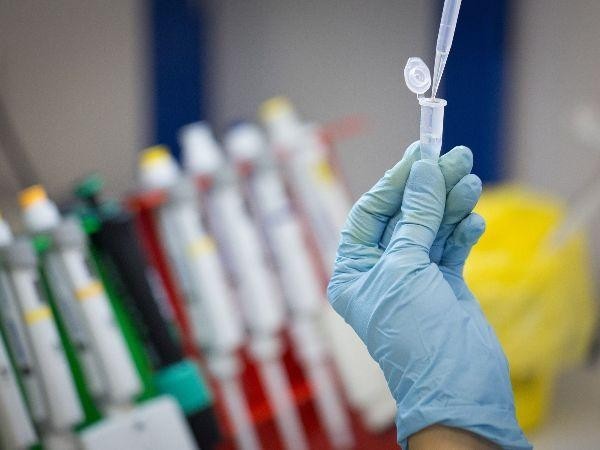 Ocugen Share Price What To Expect Ig En